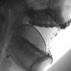Image for article titled Animations of X-rays of Mouths Talking Make Me Never Want to Talk Again
